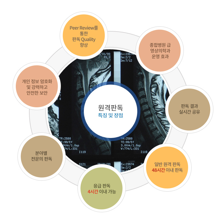 원격판독 특장점